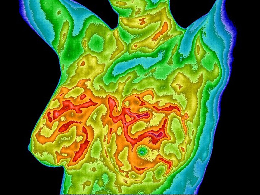 Thermogram of chest
